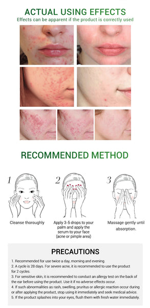Acne Pimple Patch Face Mask Skin Care Serum Face Cream Mask Facial Care Tools uses documentation