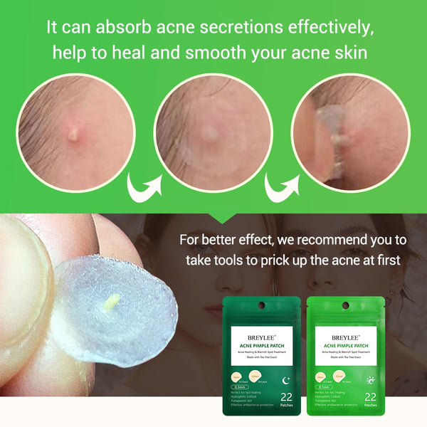 All country acceptable Acne Pimple Patch Face Mask Skin Care Serum Face Cream Mask Facial Care Tools