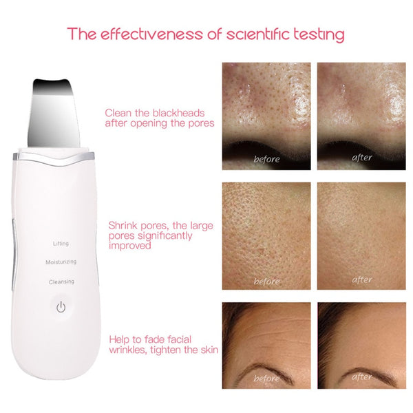 Ultrasonic Facial Skin Scrubber Ion Deep Face Cleaning Peeling health care on sell